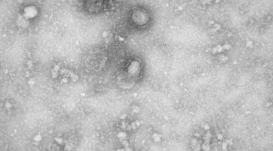 [China já tem mais de 2,3 mil mortes pelo novo coronavírus]