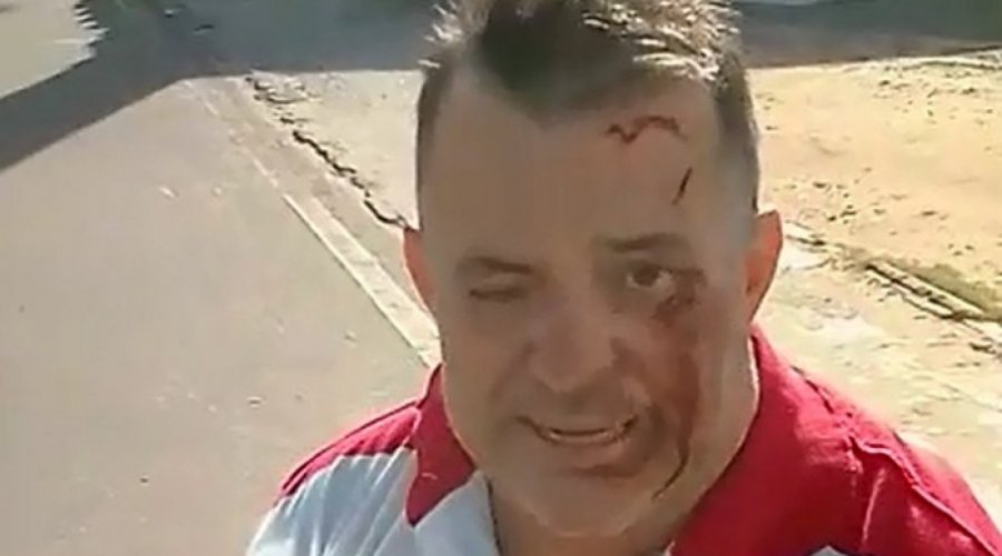[Vídeo: Renato Fechine culpa Moema Gramacho após acidente de moto]